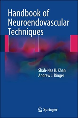Handbook of Neuroendovascular Techniques
