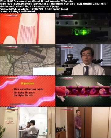 NHK Documentary - Ghost Blood Vessels (2018) 720p HDTV x264-DARKFLiX