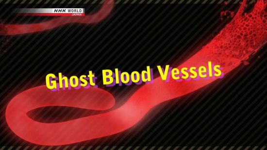 NHK Documentary - Ghost Blood Vessels (2018) 720p HDTV x264-DARKFLiX