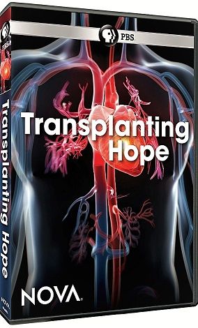PBS NOVA - Transplanting Hope (2018) 720p HDTV x264 AAC MVGroup