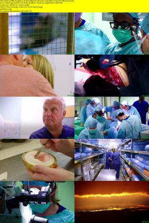 BBC - Surgeons: At the Edge of Life (2018) 720p HDTV x264 AAC MVGroup