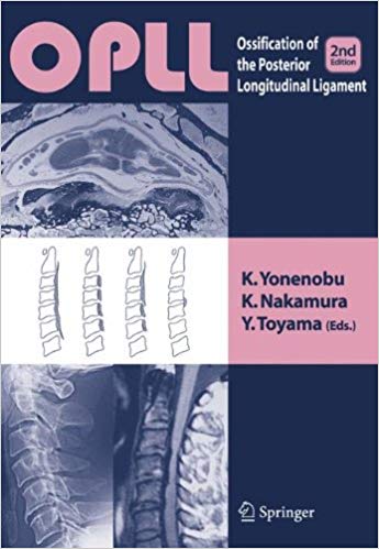 OPLL: Ossification of the Posterior Longitudinal Ligament, 2nd Edition