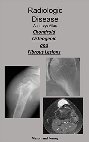 Radiologic Disease. An Imaging Atlas: Chondroid, Osteogenic, and Fibrous Lesions