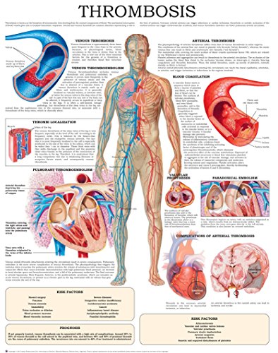 Thrombosis e-chart: Quick reference guide