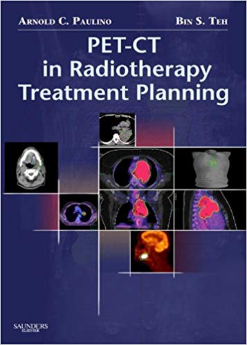 PET CT in Radiotherapy Treatment Planning