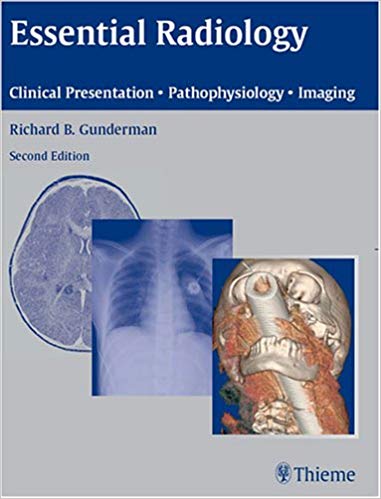 Essential Radiology: Clinical Presentation   Pathophysiology   Imaging