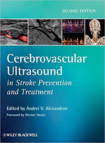 Cerebrovascular Ultrasound in Stroke Prevention and Treatment Ed 2
