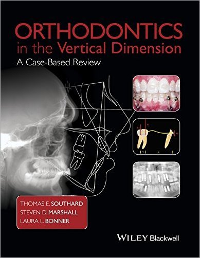 Orthodontics in the Vertical Dimension: A Case Based Review [EPUB]