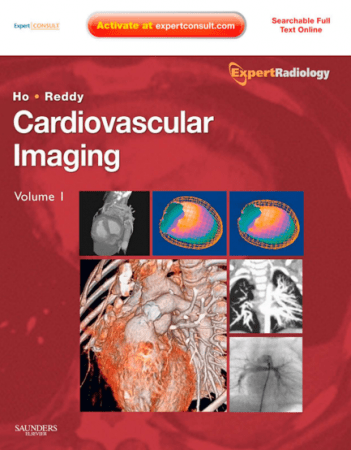 Cardiovascular Imaging, 2 Volume Set: Expert Radiology Series