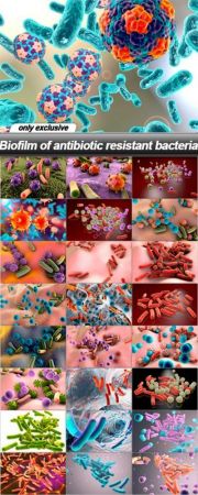  Biofilm of antibiotic resistant bacteria