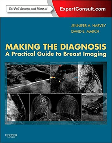 Making the Diagnosis: A Practical Guide to Breast Imaging: Expert Consult
