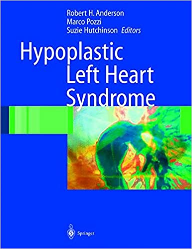 FreeCourseWeb Hypoplastic Left Heart Syndrome