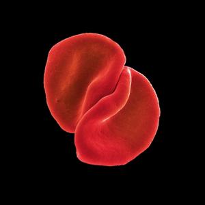 Peter Gabriel - Scratch My Back (Remastered Special Edition) (2010/2019)