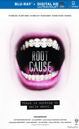 Root Cause 2019 1080p BluRay x264 AAC-YTS