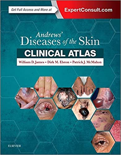 Andrews' Diseases of the Skin Clinical Atlas