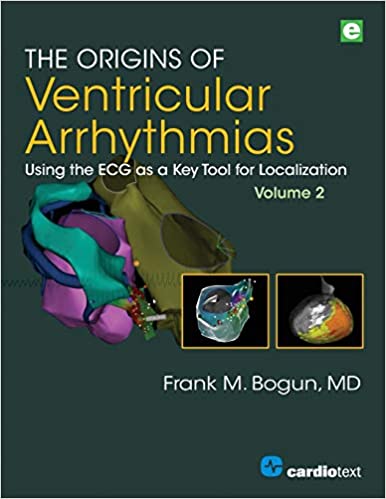 The Origins of Ventricular Arrhythmias  Using the ECG as a Key Tool for Localization, Volume 2