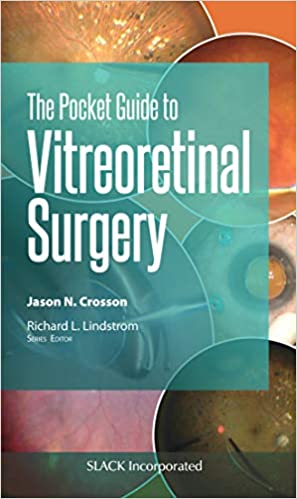 The Pocket Guide to Vitreoretinal Surgery (Pocket Guides)