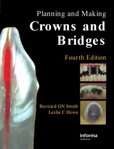 Planning and Making Crowns and Bridges, 4th Edition