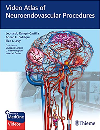 Video Atlas of Neuroendovascular Procedures, Illustrated Edition