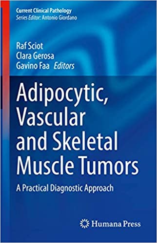Adipocytic, Vascular and Skeletal Muscle Tumors: A Practical Diagnostic Approach