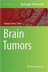 Brain Tumors (Neuromethods)