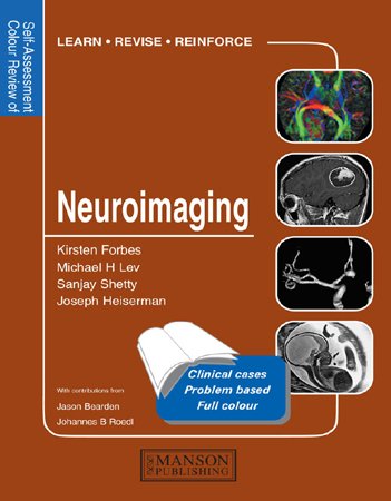 Neuroimaging: Self Assessment Colour Review