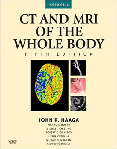 CT and MRI of the Whole Body, 2 Volume Set, 5th Edition