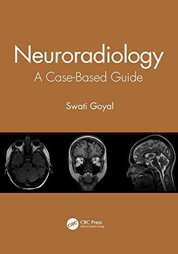 Neuroradiology: A Case Based Guide