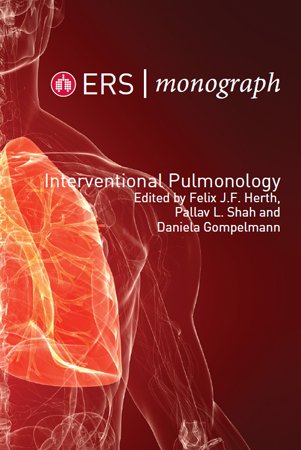 Interventional Pulmonology (ERS Monographs)