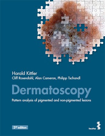 Dermatoscopy: Pattern analysis of pigmented and non pigmented lesions, 2nd Edition