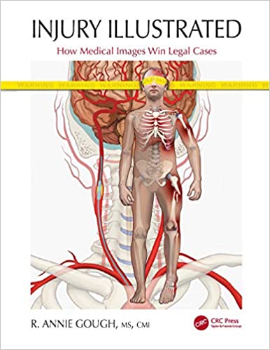 Injury Illustrated: How Medical Images Win Legal Cases (True PDF)