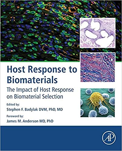Host Response to Biomaterials: The Impact of Host Response on Biomaterial Selection