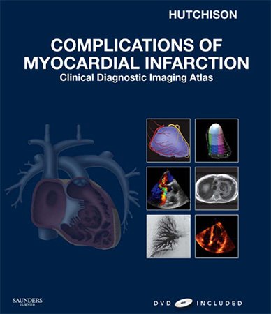 Complications of Myocardial Infarction: Clinical Diagnostic Imaging Atlas
