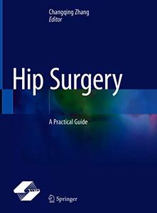 Hip Surgery: A Practical Guide (EPUB)