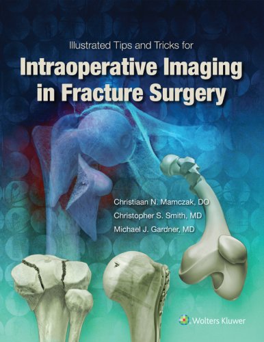 llustrated Tips and Tricks for Intraoperative Imaging in Fracture Surgery