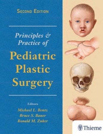 Principles and Practice of Pediatric Plastic Surgery