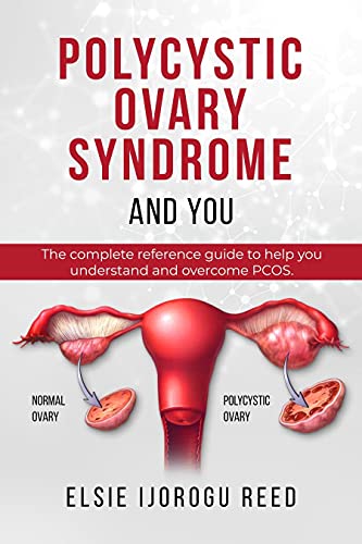 Polycystic Ovary Syndrome And You: The complete reference guide to help you understand and overcome PCOS
