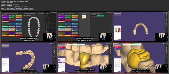 Digital flow in dentistry and basic exocad program