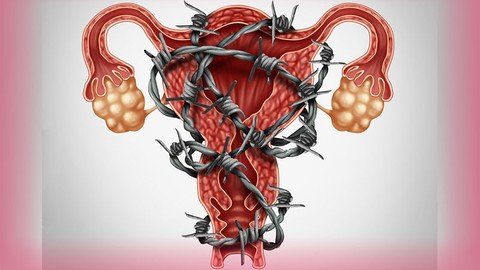 Optimizing Fertility In Endometriosis