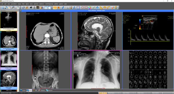 instal the new version for iphoneSante DICOM Viewer Pro 12.2.5