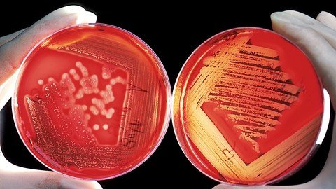 Microbiology: Characterization &amp; Identification