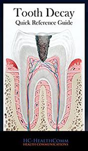 Tooth decay- Quick Reference Guide: Full illustrated