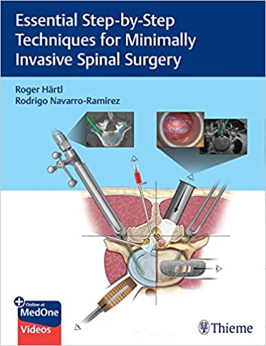 Essential Step-By-Step Techniques for Minimally Invasive Spinal Surgery 1st Edition