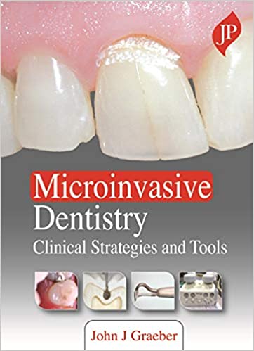 Microinvasive Dentistry, Clinical Strategies and Tools 1st Edition