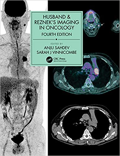 Husband &amp; Reznek's Imaging in Oncology 4th Edition