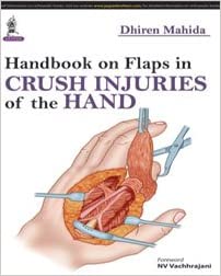 Handbook on Flaps in Crush Injuries of the Hand 1st Edition