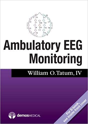 Ambulatory EEG Monitoring 1st Edition