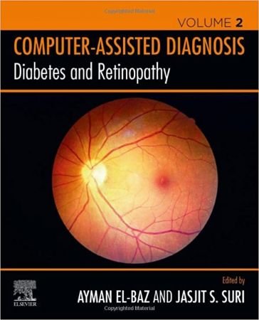 Diabetes and Retinopathy (Computer-Assisted Diagnosis) (Volume 2) 1st Edition