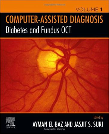 Diabetes and Fundus OCT (Computer-Assisted Diagnosis) (Volume 1) 1st Edition