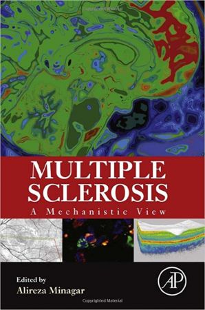 Multiple Sclerosis: A Mechanistic View